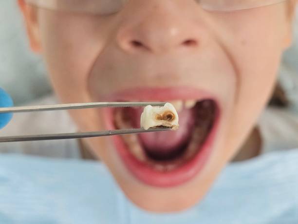 Best Emergency Orthodontic Repairs in Little Walnut Village, NM